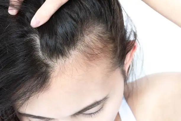 Is Biotin Powder Good for Hair Growth? Find Out Now!